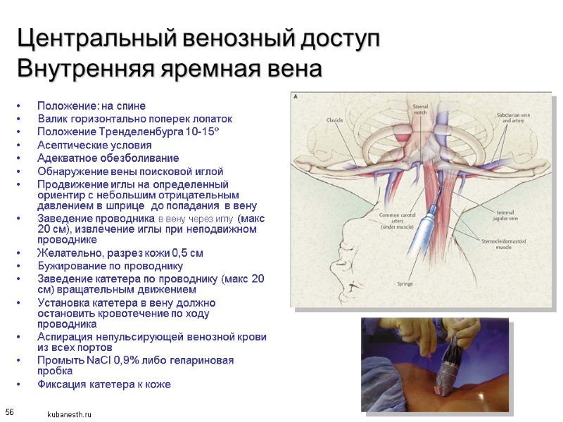 56 Центральный венозный доступ Внутренняя яремная вена Положение: на спине Валик горизонтально поперек лопаток